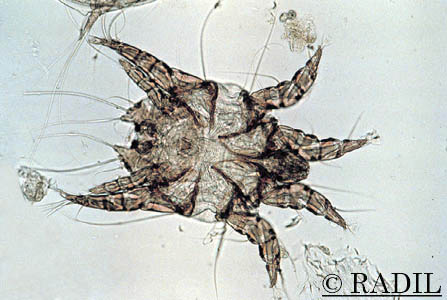 Ácaro masculino visto al microscopio