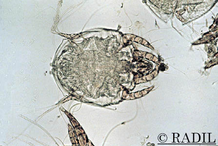 Ácaro femenino visto al microscopio